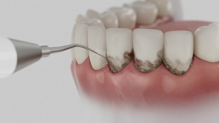 Reliable Teeth Cleaning And Checkup contractor in Chesterfield County County, VA by Dentist Open Now
